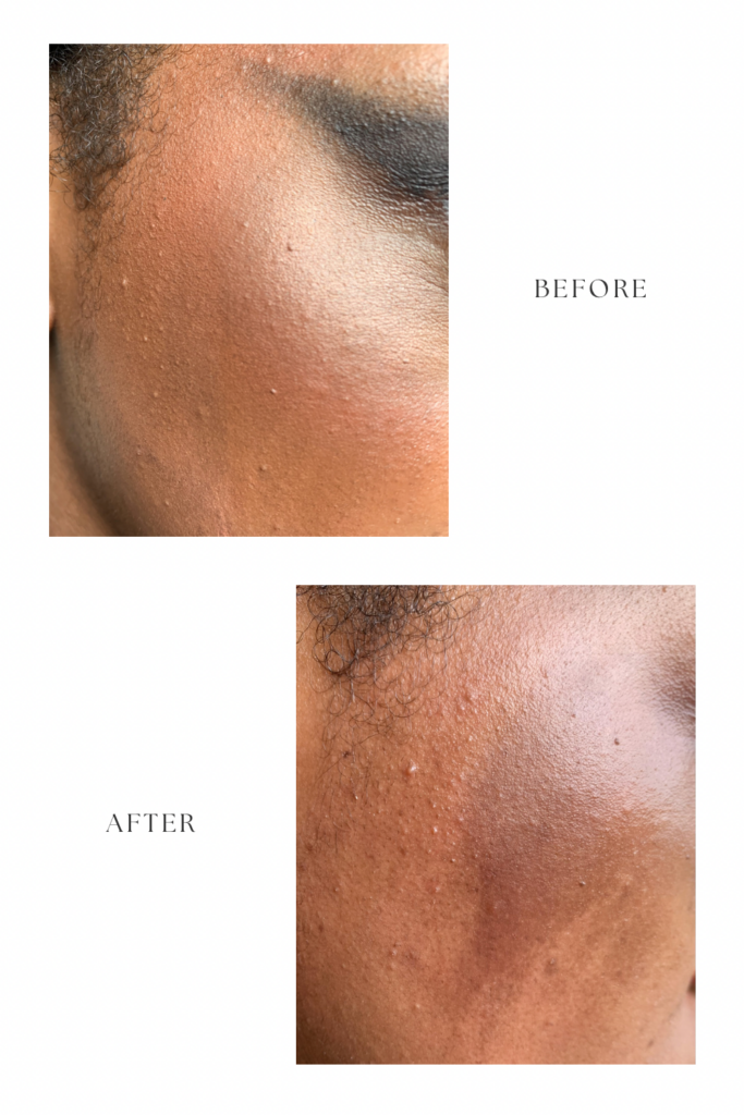Image showing before and after using the simple micellar cleansing water