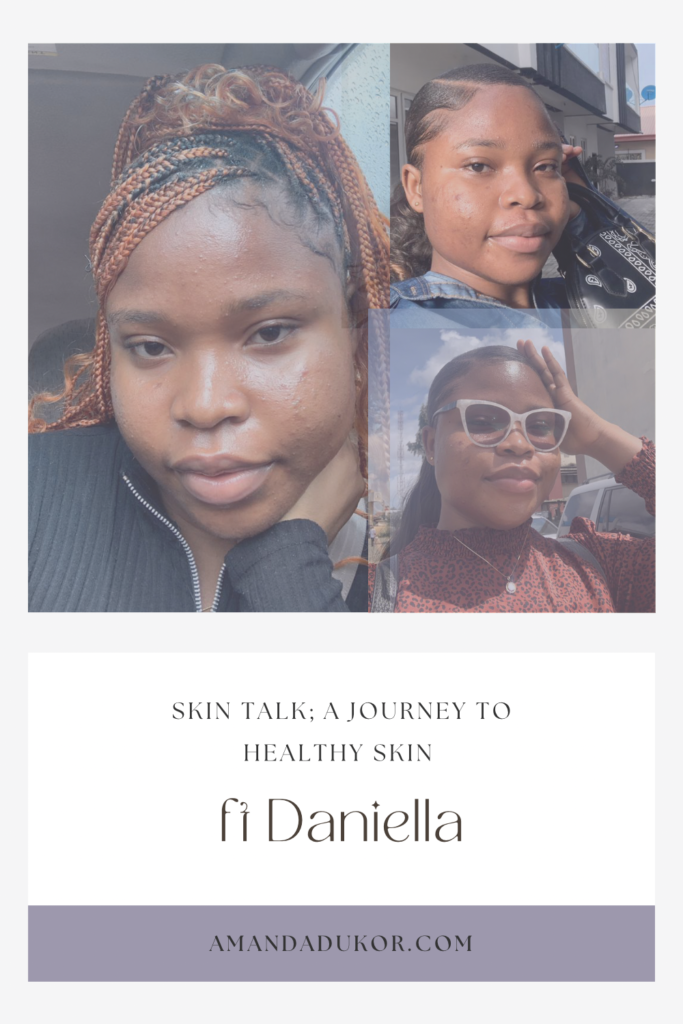 Pinterest pin for Skin talk ft Daniella’s journey to healthy skin